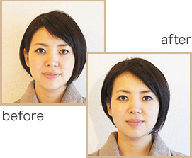 before−after